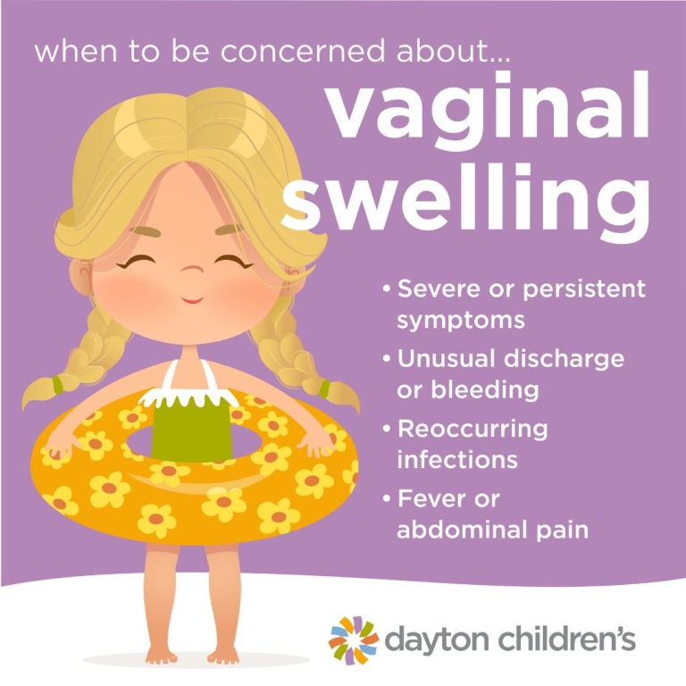 when to be concerned about vaginal swelling