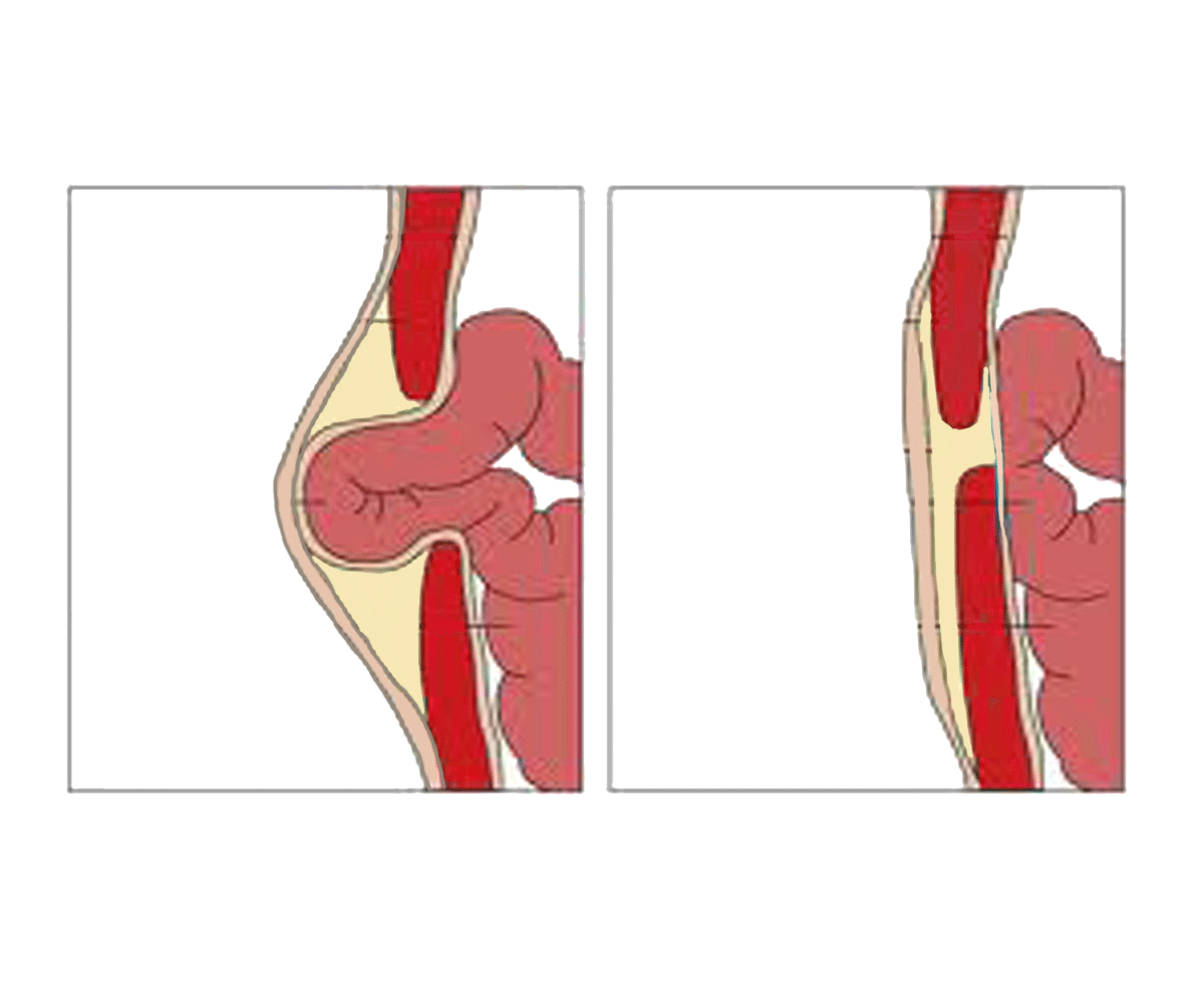 Exercises for adults and children with scoliosis, hernia and osteochondrosis, as well as for preventive purposes Exercises for adults and children with scoliosis, hernia and osteochondrosis, as well as for preventive purposes