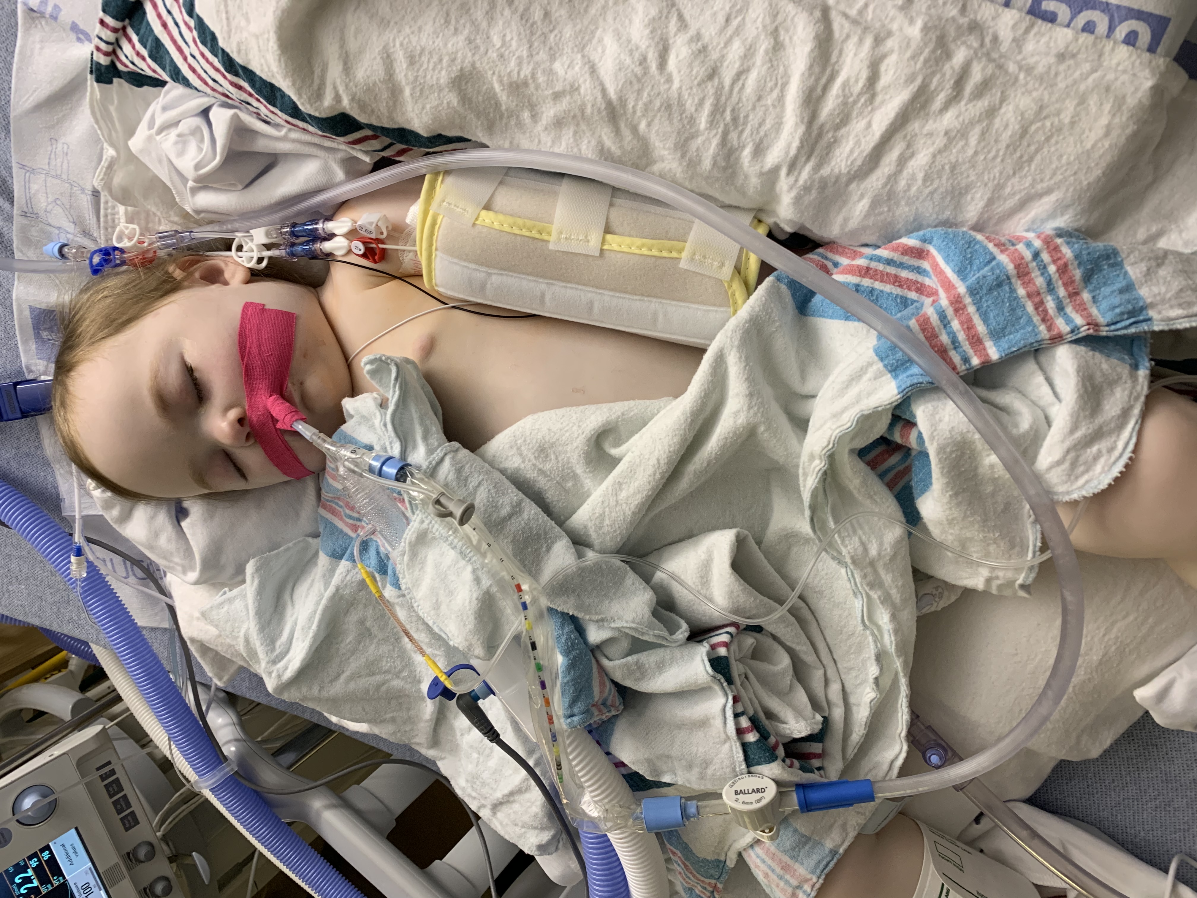 ava coder laying in bed in the pediatric ICU being monitored