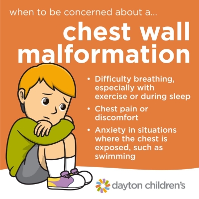 when to be concerned about a chest wall malformation