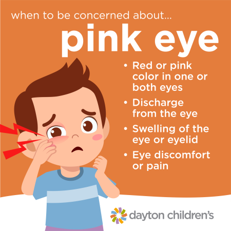 when to be concerned about pink eye graphic