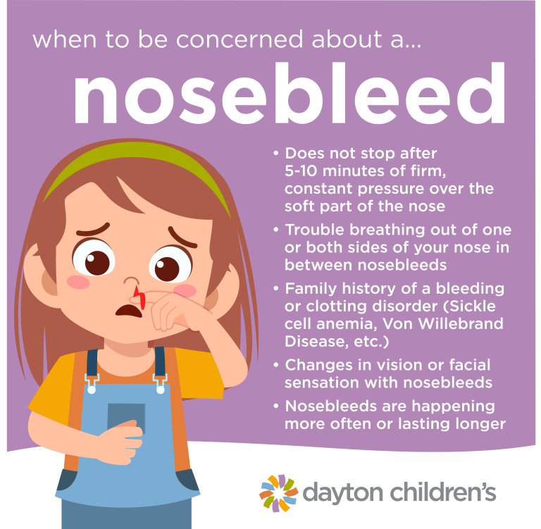 when to be concerned about a nosebleed