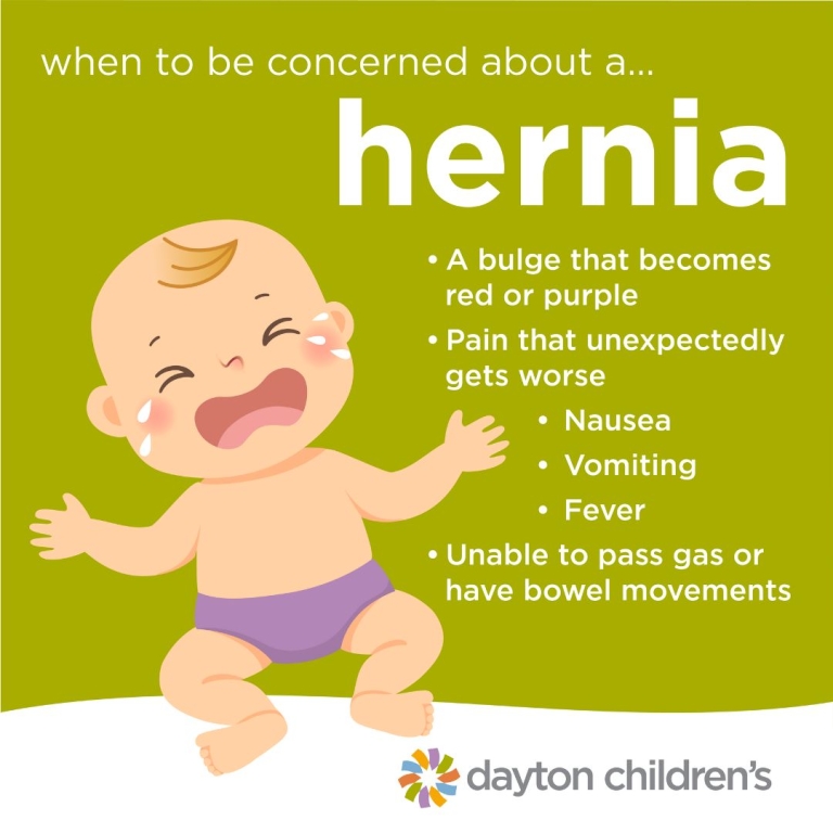 when to be concerned about a hernia