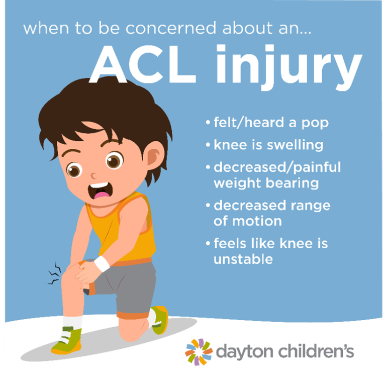 when to be concerned about an ACL injury from Dayton Children's