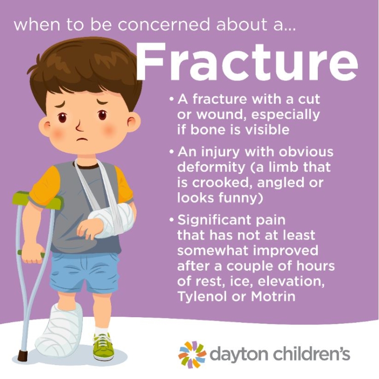 when to be concerned about a fracture graphic