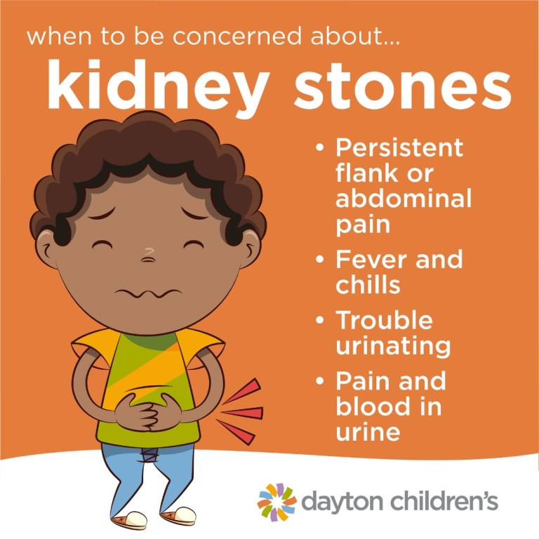 when to be concerned about kidney stones