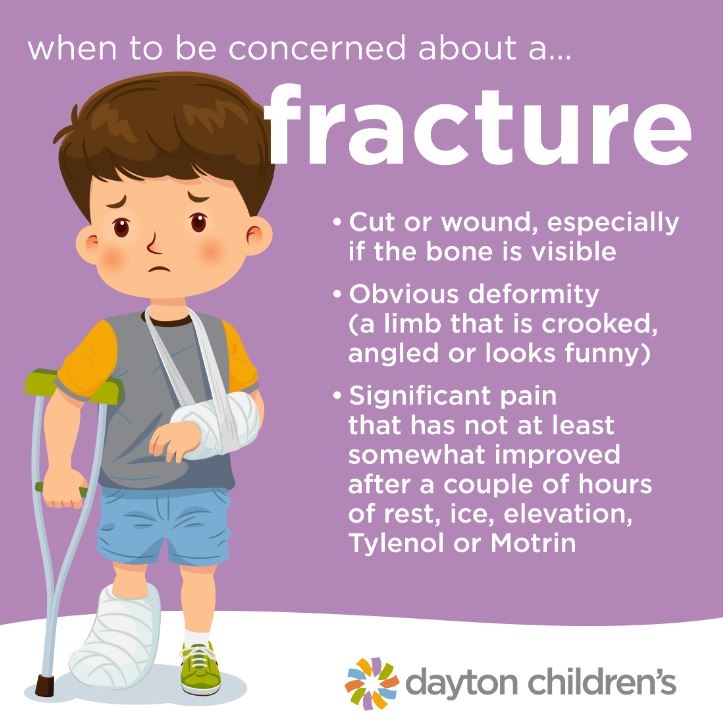 when to be concerned about a fracture